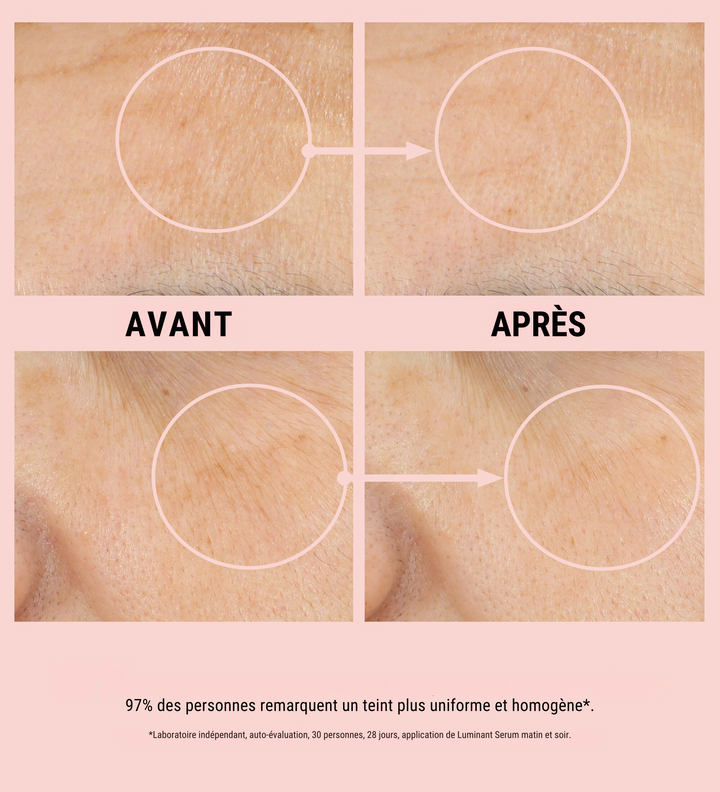 Résultats avant et après l'utilisation des produits Comfort Zone Luminant. La photo montre deux ensembles de comparaisons avant et après, mettant en évidence une amélioration significative de la texture et de l'homogénéité de la peau. 97% des personnes remarquent un teint plus uniforme et homogène après utilisation.